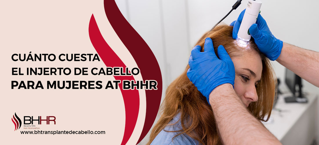 Precio De Injerto De Cabello En Mujeres