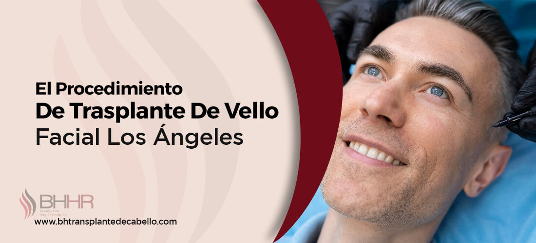 trasplante de vello facial los angeles