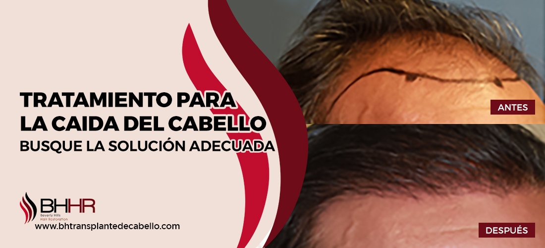 Tratamiento Para La Caida Del Cabello